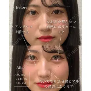 ROHE CLINIC GINZAの症例