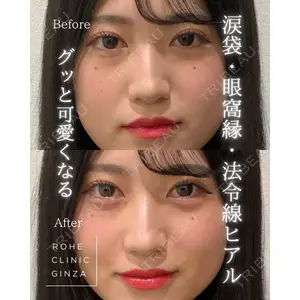 ROHE CLINIC GINZAの症例