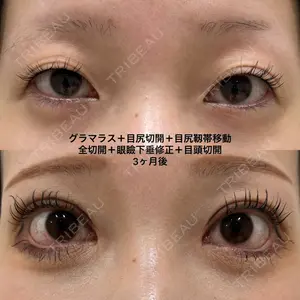 エターナル美容クリニック 久門田 詳医師の症例