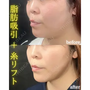 THE FIRST CLINIC 町田院 木暮 啓一郎医師の症例