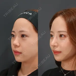 LIVIN CLINIC 新行内 芳明医師の症例