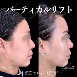 EMMO FACE CLINIC 大宮院 百瀬 直也医師の症例