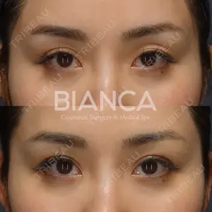 BIANCA銀座の症例