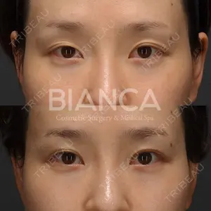 BIANCA銀座 堀田 和亮医師の症例