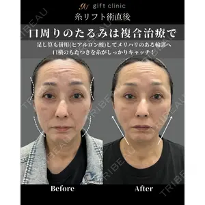 gift clinic 能登谷 翔医師の症例