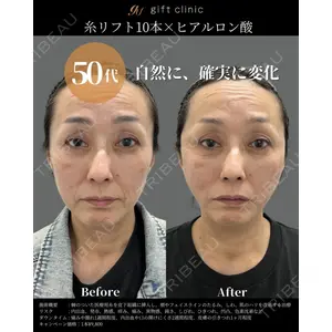gift clinic 能登谷 翔医師の症例
