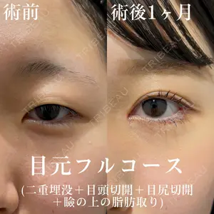綺翠 -kisui Clinic 伊藤 翼医師の症例
