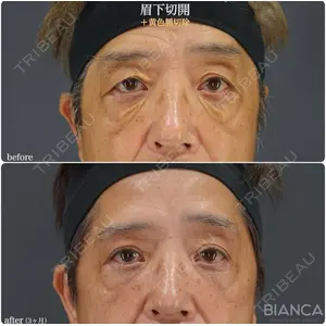 BIANCA銀座 魚谷 雄一朗医師の症例