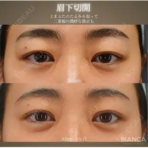 BIANCA銀座 魚谷 雄一朗医師の症例