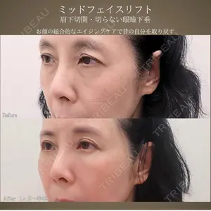 BIANCA銀座 魚谷 雄一朗医師の症例
