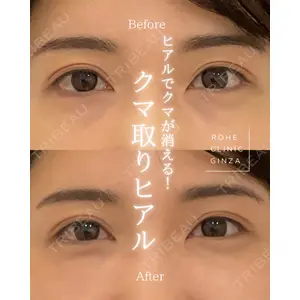 ROHE CLINIC GINZAの症例