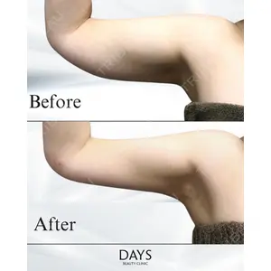 Days Beauty Clinicの症例