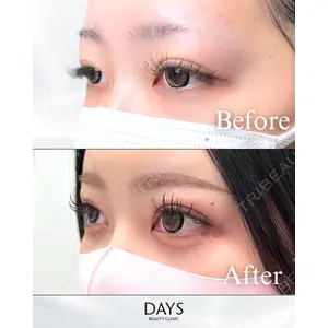 Days Beauty Clinicの症例