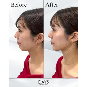 Days Beauty Clinicの症例