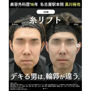 湘南美容クリニック 名古屋駅本院 高川 裕也医師の症例