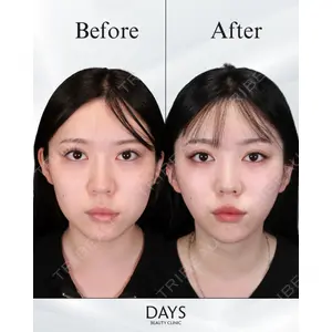 Days Beauty Clinic 山野 祐医師の症例