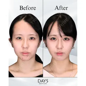 Days Beauty Clinic 山野 祐医師の症例