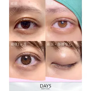 Days Beauty Clinicの症例