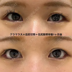 エターナル美容クリニック 久門田 詳医師の症例