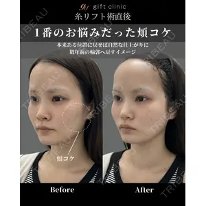 gift clinic 能登谷 翔医師の症例