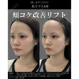 gift clinic 能登谷 翔医師の症例