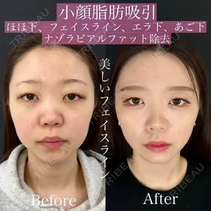 ルラ美容クリニック 渋谷本院 昼間 路子医師の症例