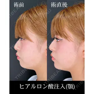 HAAB×DREAM BEAUTY CLINIC 大阪梅田院 柏木 太雅医師の症例