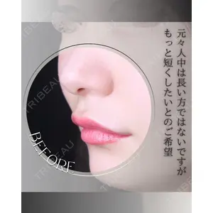 小倉美容外科/美容皮膚科 ビラビューティークリニック 大村 亞蘭医師の症例