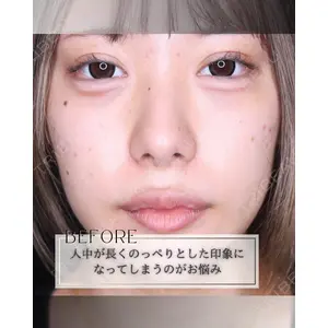 小倉美容外科/美容皮膚科 ビラビューティークリニック 大村 亞蘭医師の症例