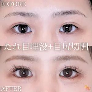 SK新宿歌舞伎町美容外科・歯科の症例