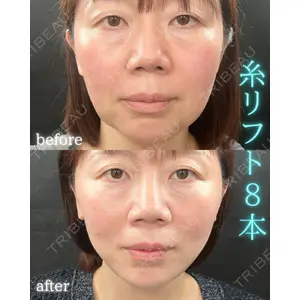 THE FIRST CLINIC 町田院 木暮 啓一郎医師の症例