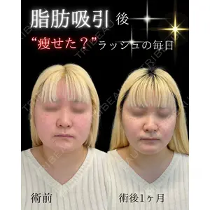 ルラ美容クリニック 池袋院 日名地 あゆみ医師の症例