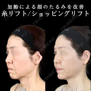 アリエル美容クリニック 横浜院 渡邉 光医師の症例