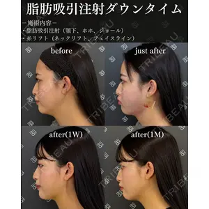 EMMO FACE CLINIC 大阪梅田院 神谷 一成医師の症例