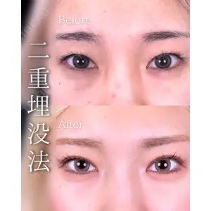 東京シンデレラ美容外科 池袋院 石井 達也医師の症例