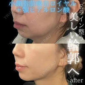THE FIRST CLINIC 多摩センター院 惟村 公郁医師の症例