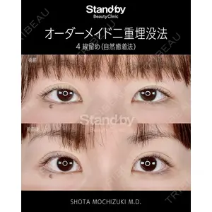Stand by Beauty Clinic 望月 聖太医師の症例
