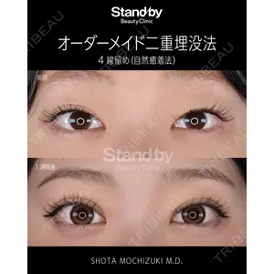 Stand by Beauty Clinic 望月 聖太医師の症例