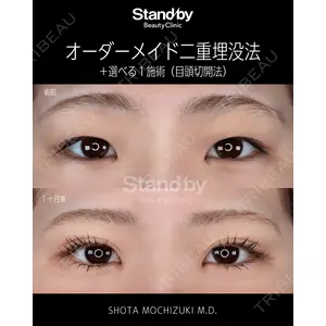 Stand by Beauty Clinic 望月 聖太医師の症例