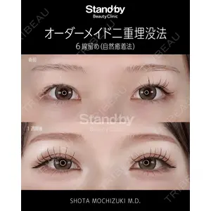 Stand by Beauty Clinic 望月 聖太医師の症例