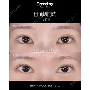 Stand by Beauty Clinic 望月 聖太医師の症例