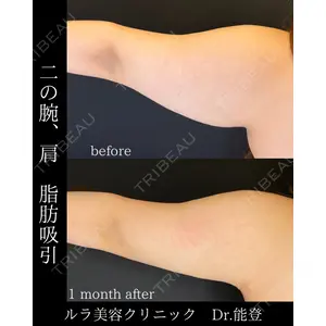 ルラ美容クリニック 札幌院 能登 貴弘医師の症例