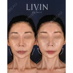 LIVIN CLINIC 新行内 芳明医師の症例