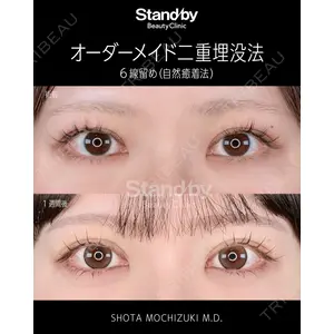 Stand by Beauty Clinic 望月 聖太医師の症例