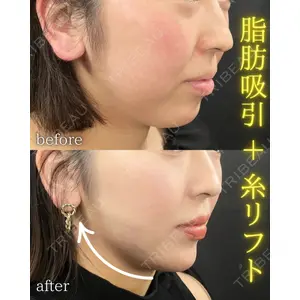 THE FIRST CLINIC 町田院 木暮 啓一郎医師の症例