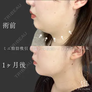 ziz CLINIC 村岡 史子医師の症例