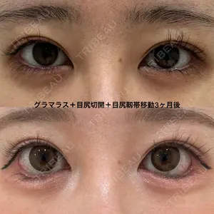 エターナル美容クリニックの症例