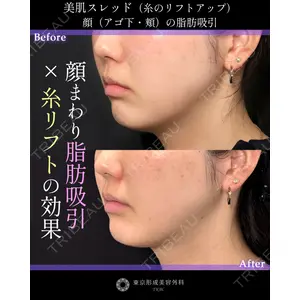 東京形成美容外科 銀座院 中尾 真紀医師の症例
