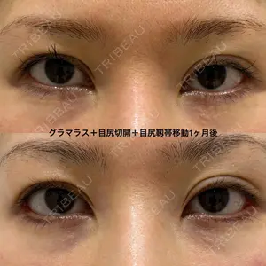 エターナル美容クリニック 久門田 詳医師の症例