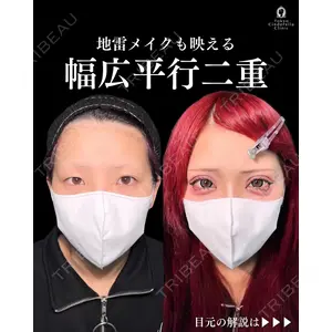 東京シンデレラ美容外科 新宿院 吉原 伯医師の症例